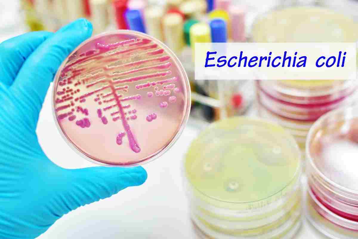 escherichia coli formaggio francese 